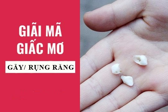 Mơ thấy rụng răng là điềm báo gì?